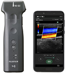 ワイヤレス超音波画像診断装置　iViz air（リニア）　富士フイルムメディカル株式会社