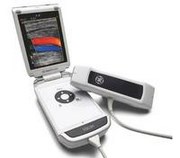 汎用超音波画像診断装置　Vscan Dual Probe　GEヘルスケア・ジャパン株式会社